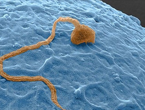 Сперматозоид обладает возможностью быстро перемещаться в организме 